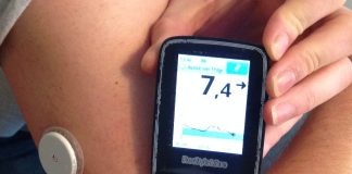 В НГТУ научились определять уровень сахара в крови без прокола кожи